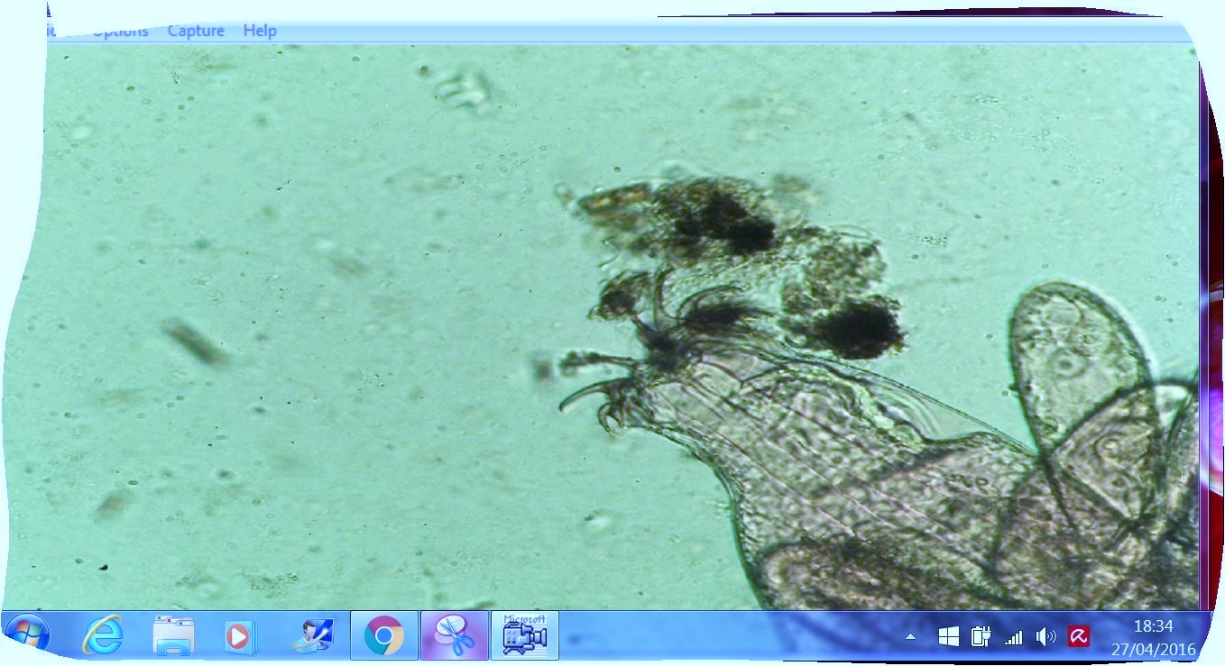 chironomus